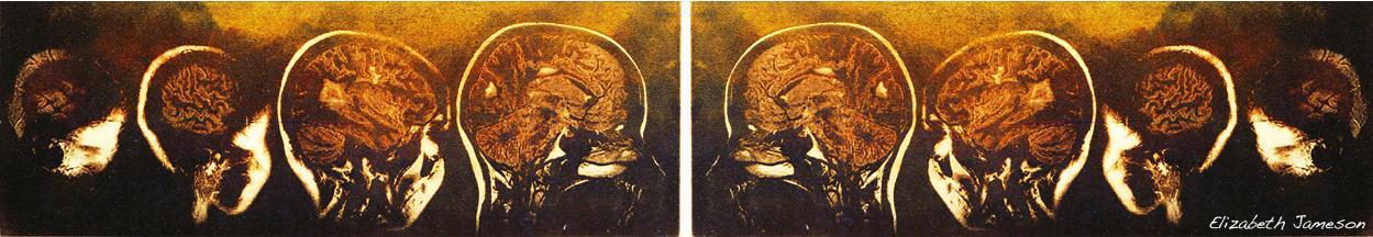 brains